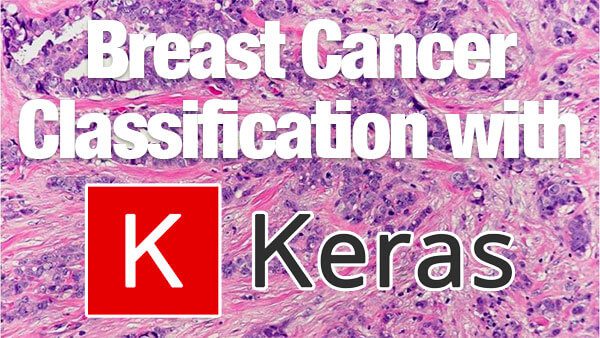 Breast Cancer Classification With Keras And Deep Learning - 