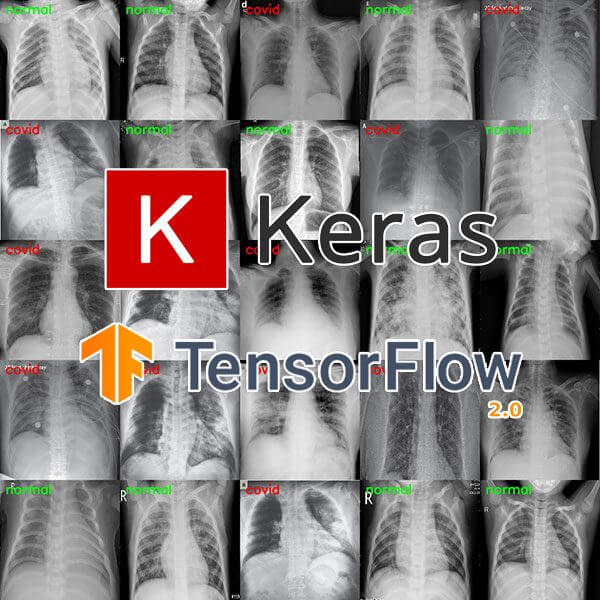 Detecting COVID-19 in X-ray images with Keras, TensorFlow, and Deep Learning